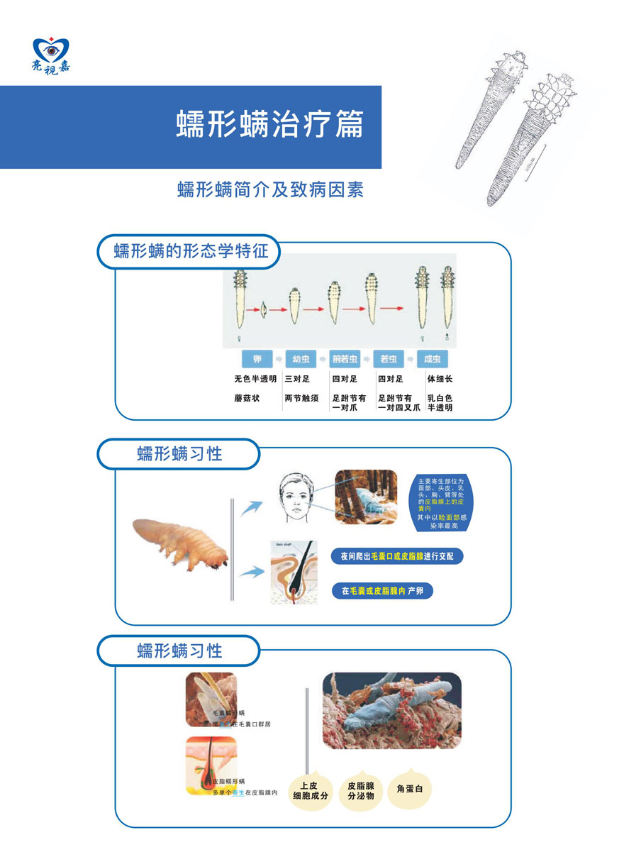 (干眼门诊文宣)蠕形螨简介及治病因素