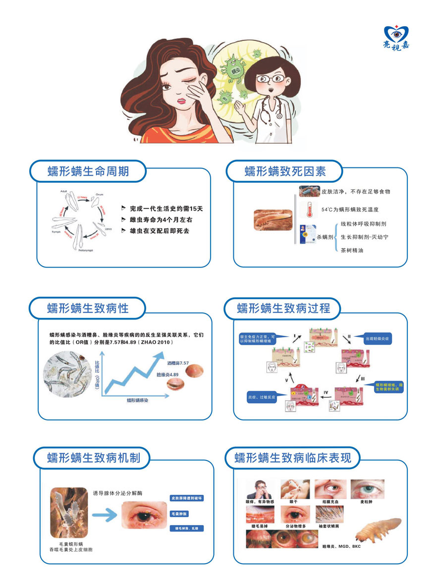 (干眼门诊文宣)蠕形螨简介及治病因素